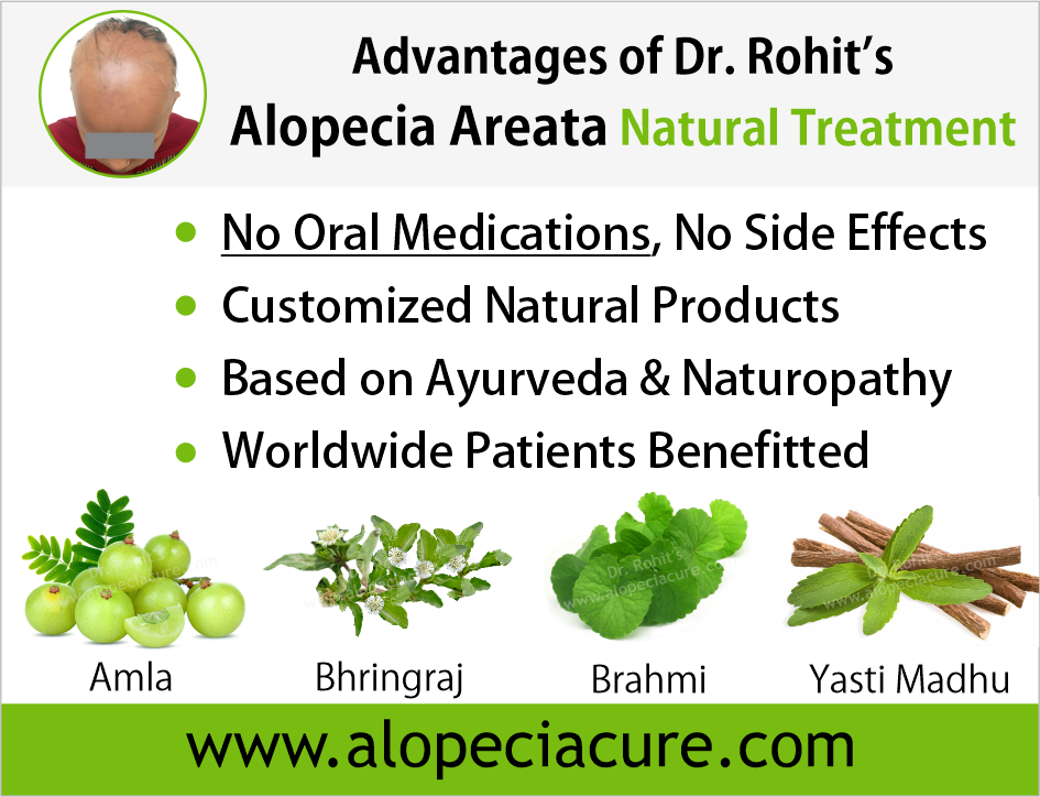 Advantages of Dr. Rohit's Alopecia Areata Natural Treatment